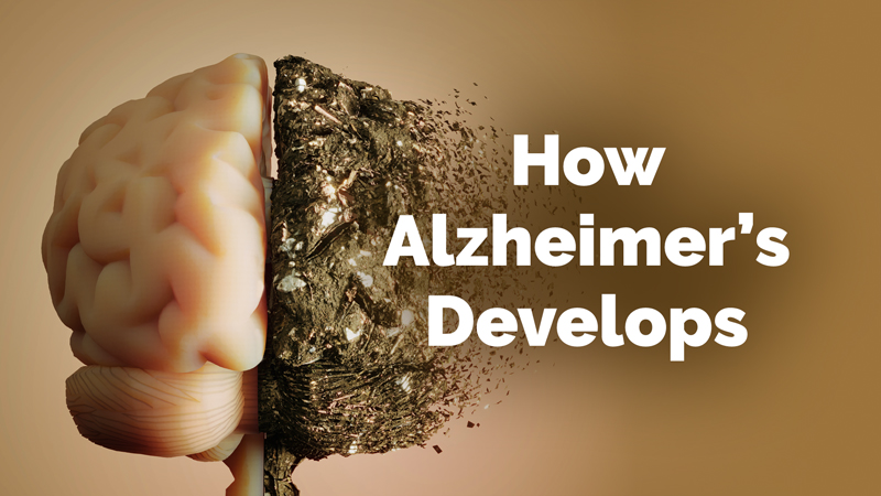 How Genetics Is Changing Alzheimer’s Disease Research
